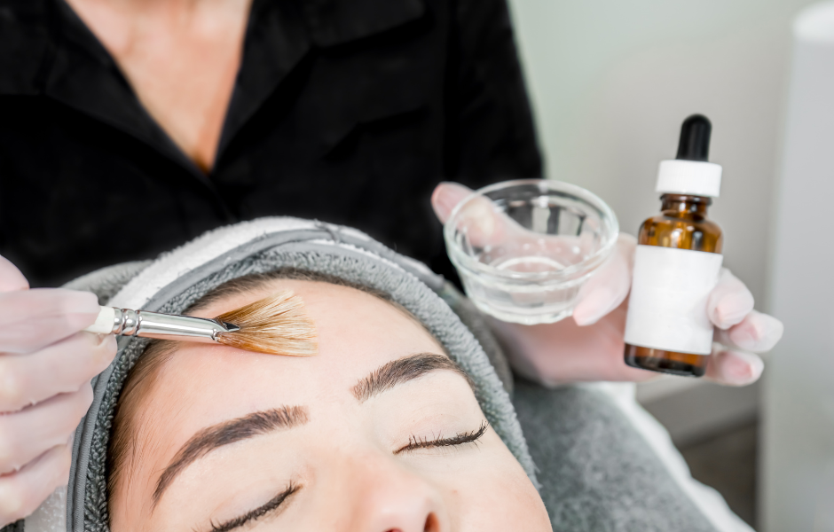 What are the Pros and Cons of a Chemical Peel?